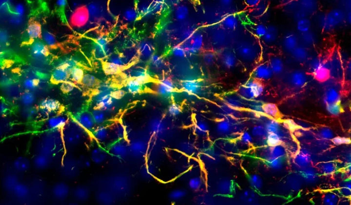 Brain recognizes speech under anesthesia