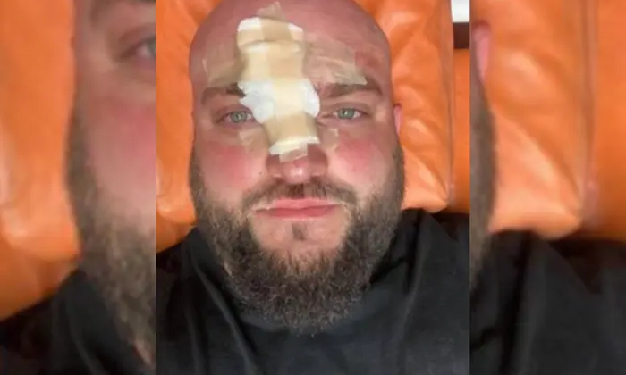 ATO veteran beaten with rebar at base