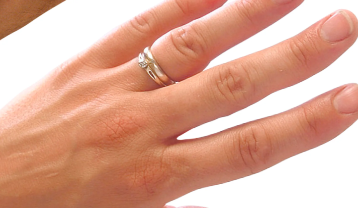 Image of reddened lunula on nail