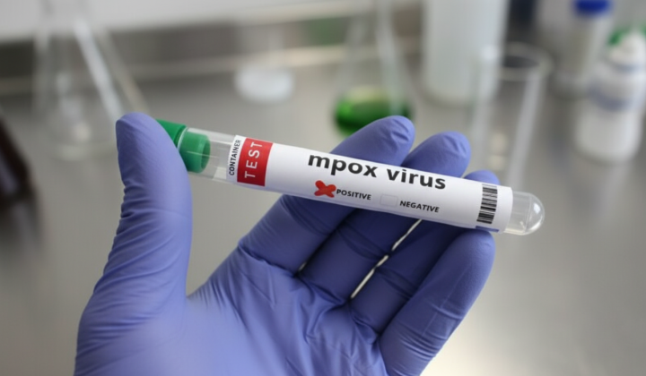 Monkeypox outbreak in Europe