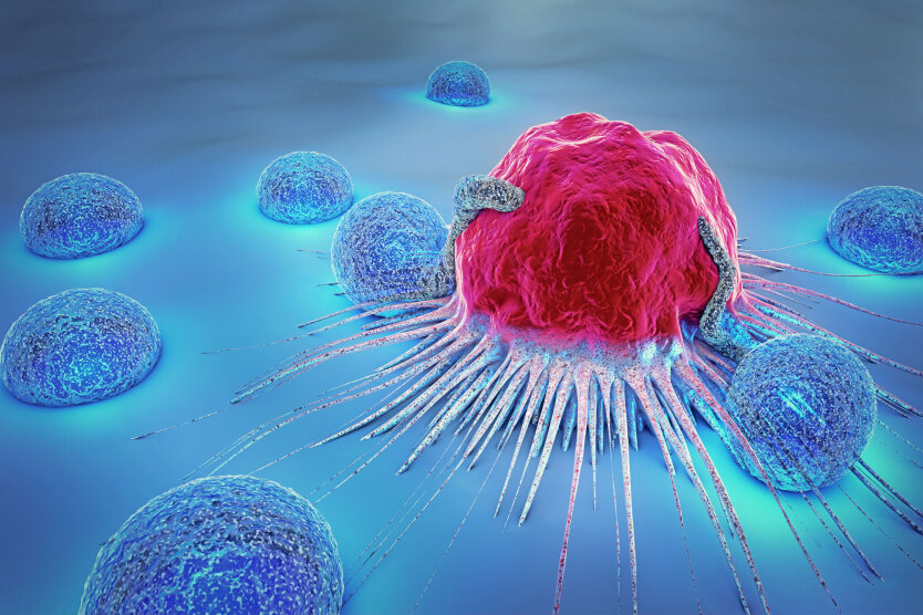 Мужчины страдают от раковых заболеваний в Украине